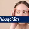 ศัลยกรรมถุงใต้ตา-ผ่าตัดถุงใต้ตา